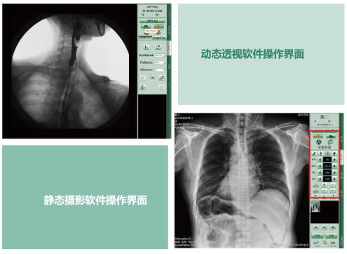 動態(tài)dr