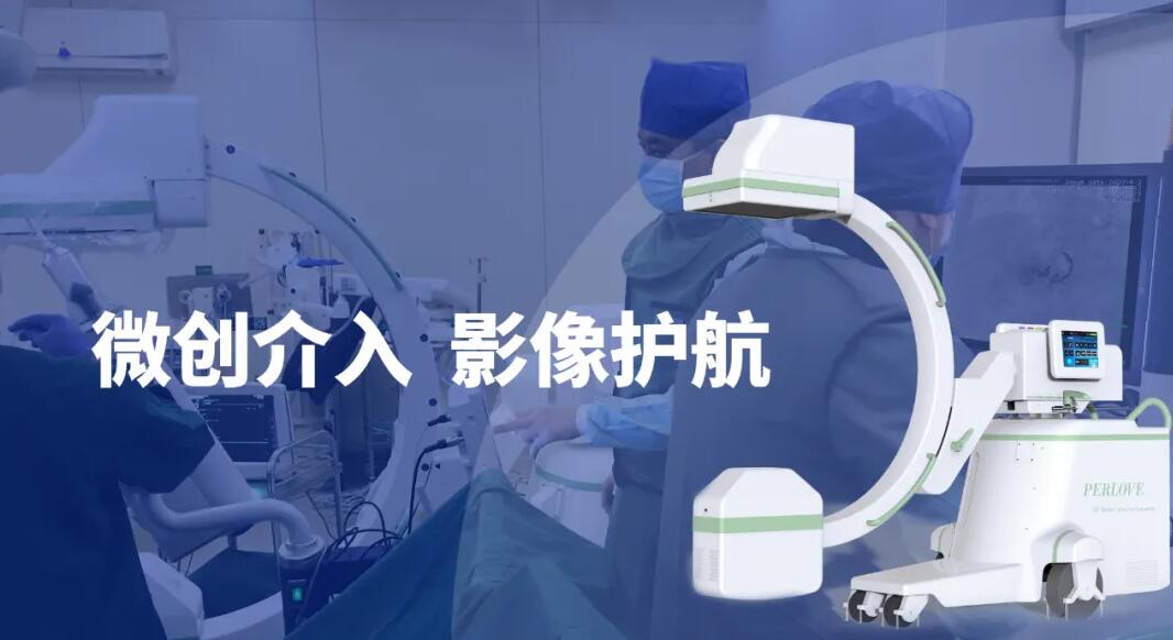 高清影像介入c臂機助力微創(chuàng)介入手術(shù)更成功