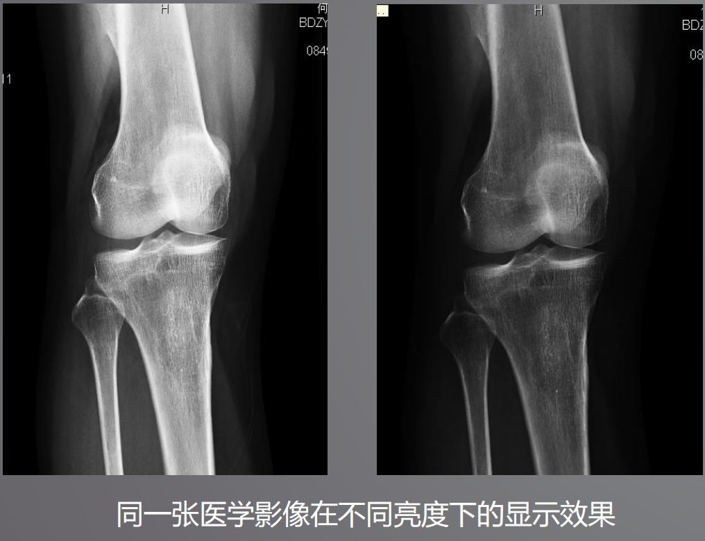 寵物DR設(shè)備的顯示器有要求？普通和醫(yī)用顯示器有什么區(qū)別