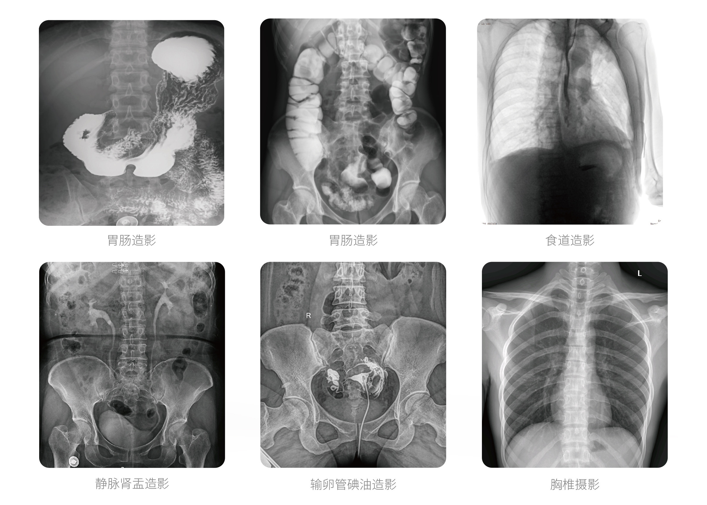 PLX8500E動(dòng)態(tài)U臂DR臨床影像